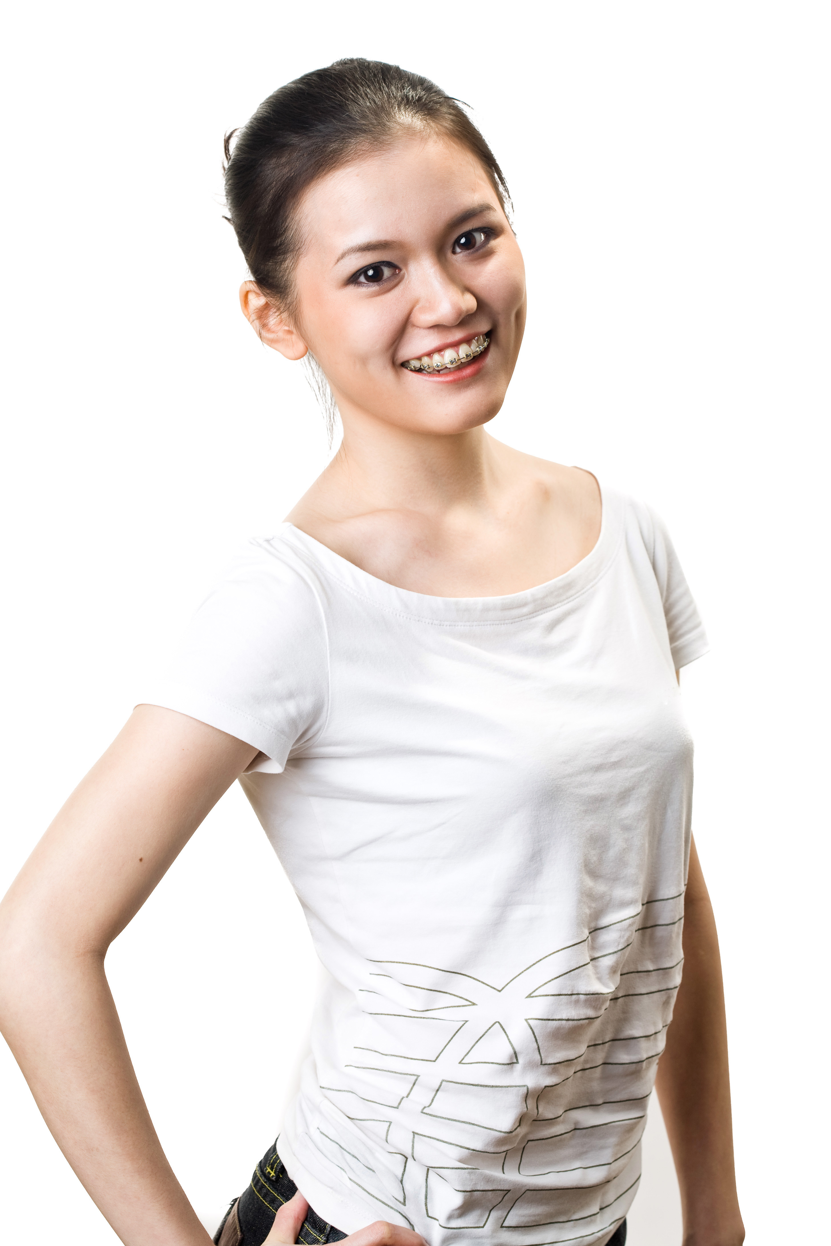 happy smiling asian young woman with braces